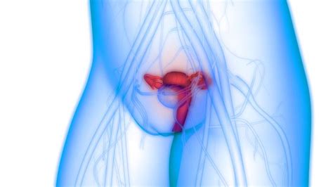 Mal Au Ovaire Quand Je Tousse - Cancer de l'ovaire BRCA-muté : intérêt d’un inhibiteur de PARP sur la