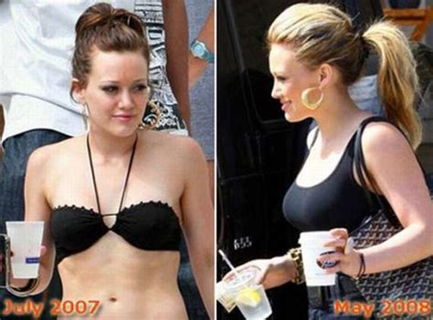 Brighton Beach Celebrities Before And After Breast Implants