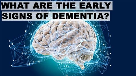 What are the early signs of dementia? - YouTube