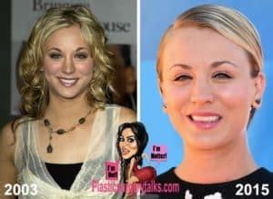 Kaley Cuoco Topless Before And After Plastic Surgery
