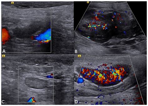 Colour Doppler Ultrasound Images Of Canine Loco Regional Lymph Nodes