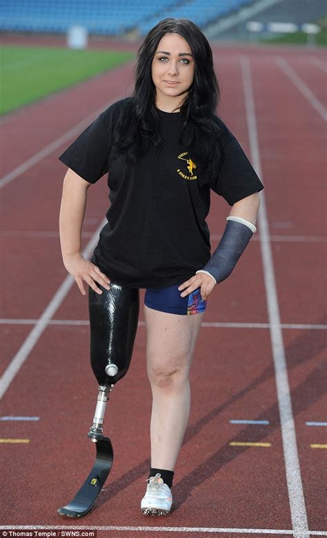 Cut Off My Foot So I Can Run Faster Says Sporty Teenager Danielle