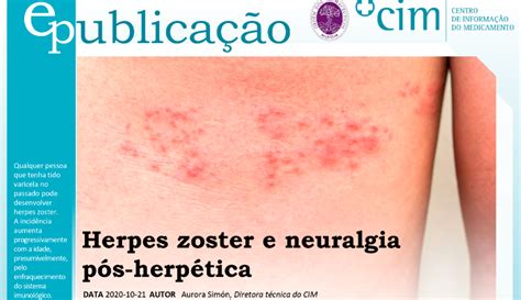 Herpes Zoster E Neuralgia Pós Herpética E Publicações Publicações