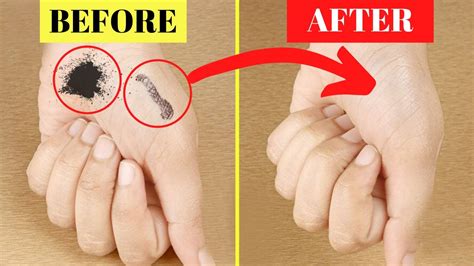 How To Remove Permanent Marker Off Skin Fast And Quickly Youtube
