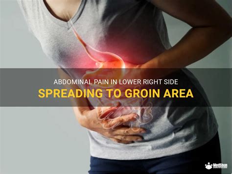 Abdominal Pain In Lower Right Side Spreading To Groin Area Medshun