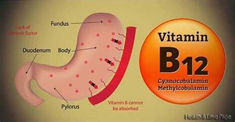 Vitamin B12 And Everything You Need To Know About It Health And Love Page