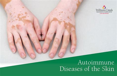 Autoimmune Diseases Of The Skin Trillium Creek Dermatology