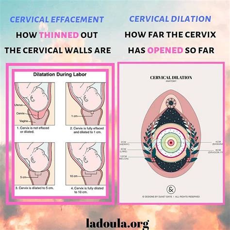 Understanding Cervical Dilation And Effacement During Pregnancy
