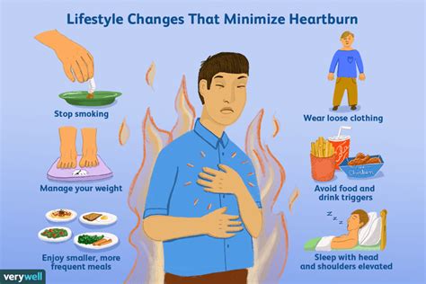 How Heartburn Is Treated