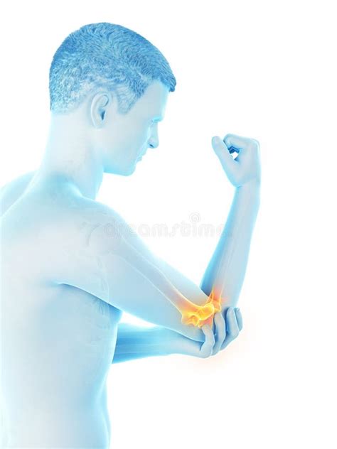 A Man With Painful Elbow Stock Illustration Illustration Of Medical