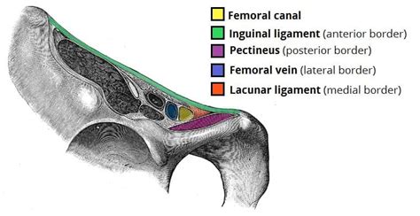 Femoral Hernia Risk Factors Clinical Features Management