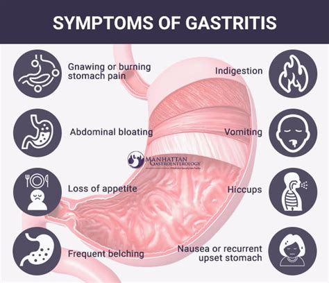 What Medicines Are Needed To Treat Gastrointestinal Signs Kintamani