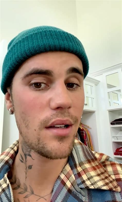 Justin Biebers Face Paralyzed After Being Diagnosed With Rare Disorder