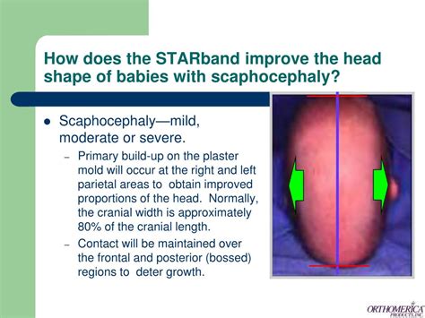 Ppt The Orthotic Management Of Infants With Deformational