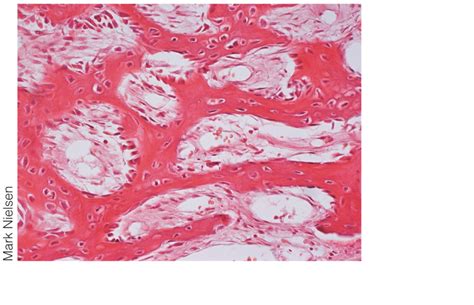 Figure 83 Gross And Microscopic Features Of Compact And Spongy Bone C Photomicrograph Of