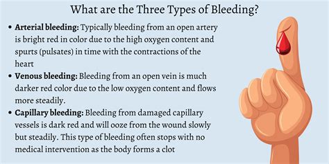 What Are The Three Types Of Bleeding First Aid For Free