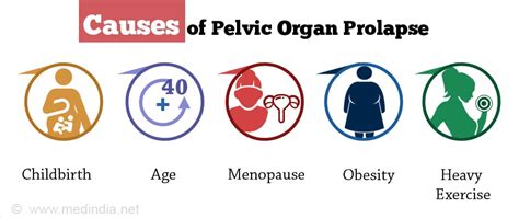 Pelvic Organ Prolapse Diagram