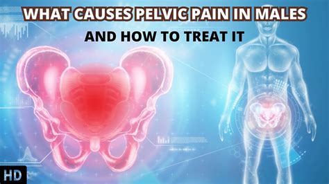 Decoding Pelvic Pain In Males Understanding The Root Causes Youtube