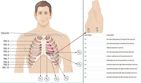 12 Leads Ecg Placement Tutorial And Ecg Cable Choosing Yqf Medical