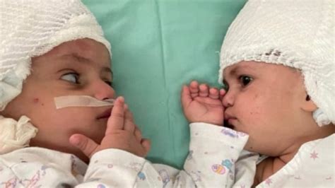 Brazilian Mother Gives Birth To Twins With Different Biological Fathers