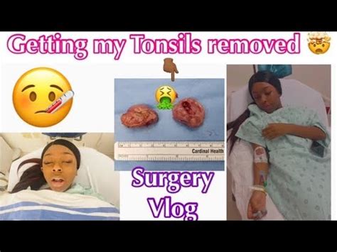 Tonsils Adenoids Surgeryhospital Vlog Full Video Short Youtube