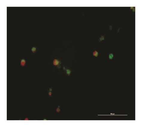 4t1 Cells Stained With Dual Staining Aopi Following Treatment With 80