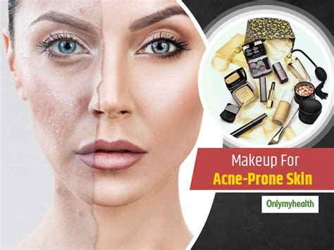Makeup Essentials For People With Acne Prone Skin Onlymyhealth