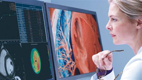 Rsna 2020 Philips Präsentiert Ki Fähige Automatisierte Radiology