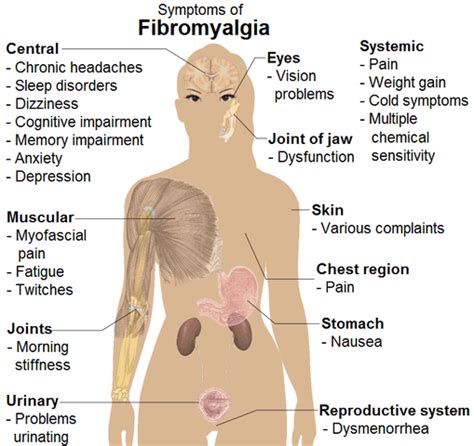 Fibromyalgia Almostadoctor