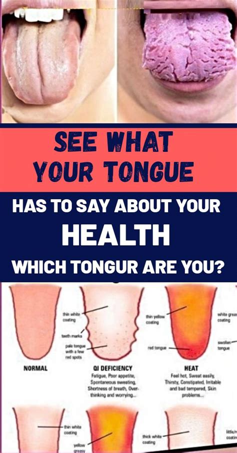 Home remedies for scalloped tongue. What Your Tongue is Trying to Tell You About Your Health ...