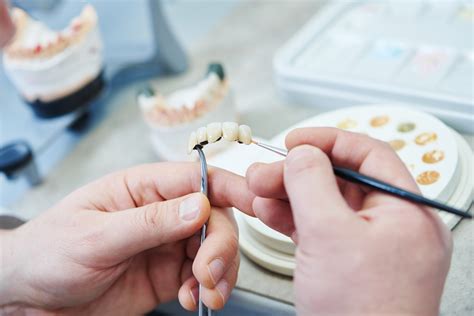 Puente dental tipos colocación precios y beneficios