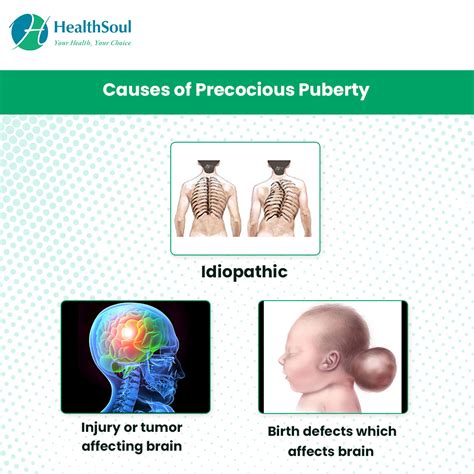 Precocious Puberty Causes And Evaluation Of Precocious Puberty Central