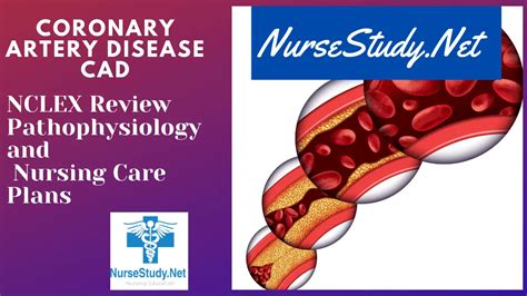 Coronary Artery Disease CAD Nursing Diagnosis Care Plan NurseStudy Net