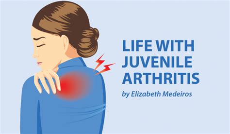 Dealing With Arthritis In The Jaw Joint Juvenile Arthritis News