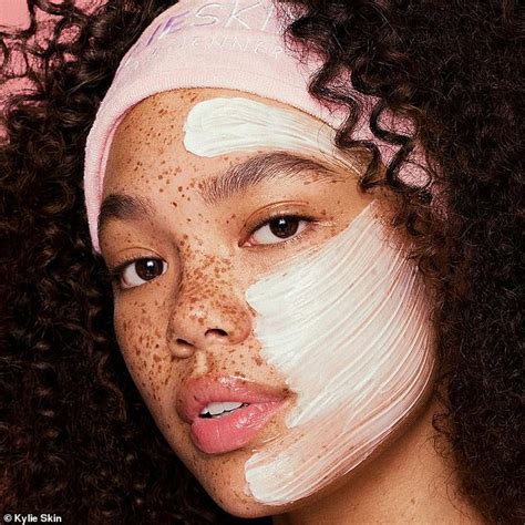 Kylie Jenner Praised For Featuring Model Covered In Freckles For Her