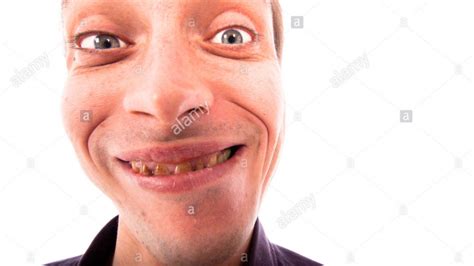 Free Download Detail Of Ugly Man Face Isolated On White Background