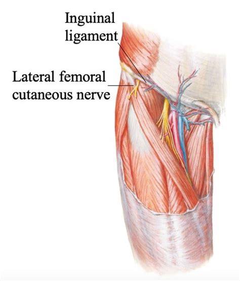 Figure Paresthesia From Meralgia Paresthetica Is Located In The Anterior Lateral And Lateral