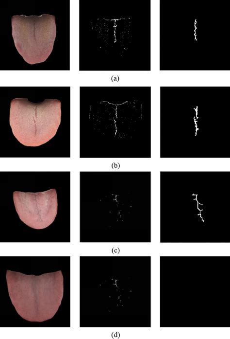 Comparison Of Crack Extraction A Single Crack Tongue B