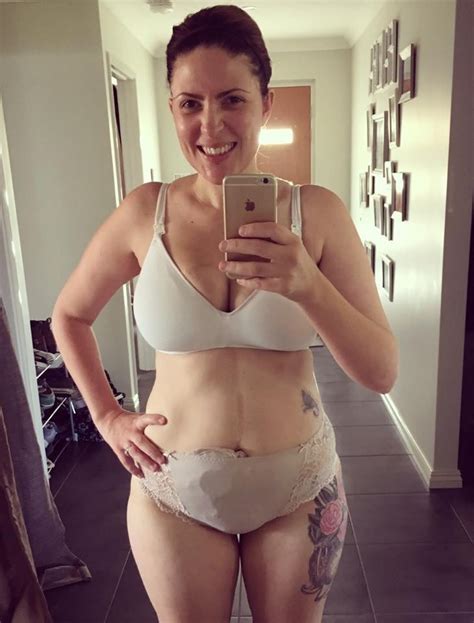 Mom S Selfies With Ileostomy Bag Popsugar Moms Photo