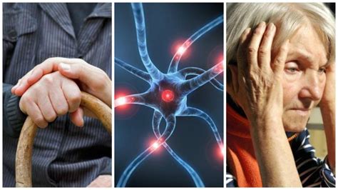 Datos Importantes Para Conocer La Enfermedad De Parkinson Mejor Con