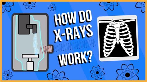 How Do X Rays Work Youtube