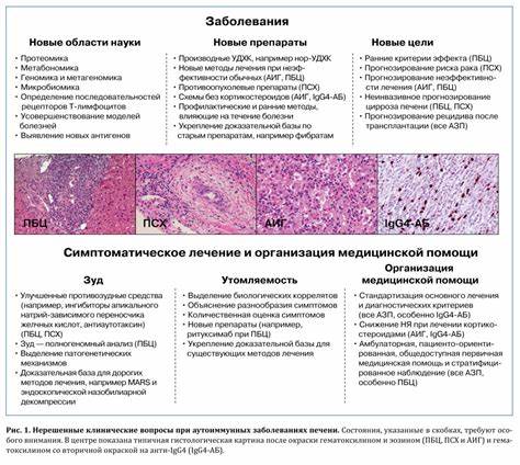 Диета при первичном Диета При Билиарном Циррозе — Похудение Диета Правильное Питание Диета При Билиарном Циррозе — Похудение Диета Правильное Питание Диета при первичном