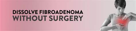 Fibroadenoma Treatment Without Surgery Ck Birla Hospital