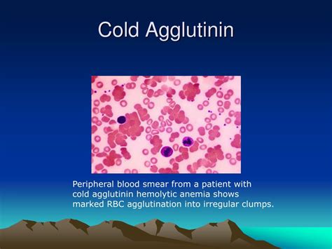 Ppt Anemia Powerpoint Presentation Free Download Id5934926