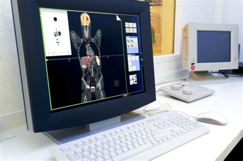 How much does a pet scan for cancer cost? PET-CT SCAN: HOW MUCH DOES IT COST? - JIVAKA.CARE