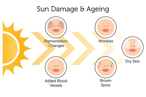 Sun Damage And Photoaging Treatment In London Rejuvence Clinic