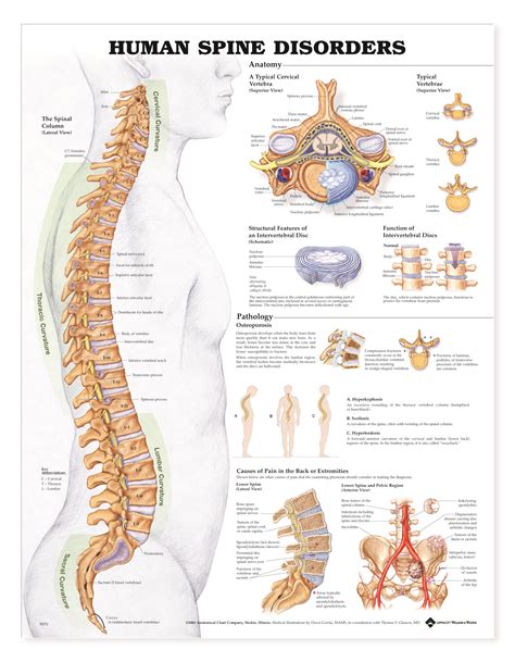 Human Spine Disorders Charts 2422