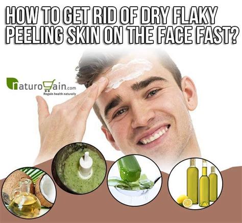 How To Get Rid Of Dry Flaky Peeling Skin On The Face Peeling Skin