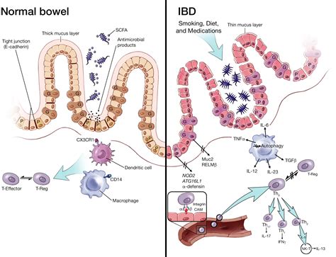 Mechanisms Of Disease Inflammatory Bowel Diseases Mayo Clinic Proceedings