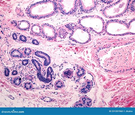 Comparison Between Eccrine And Apocrine Sweat Glands Stock Photo